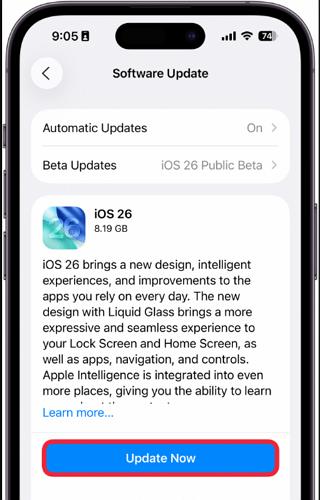 go to Software Update | Contacts Missing After iPhone Update
